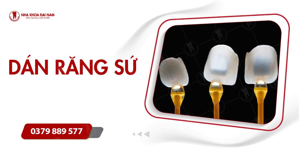 Trồng răng Implant All on 6, All on 4 - Giải pháp cho người mất răng toàn hàm