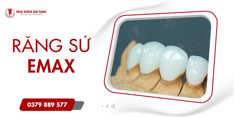 Răng sứ Emax - Ưu điểm, chi phí và địa chỉ làm răng uy tín