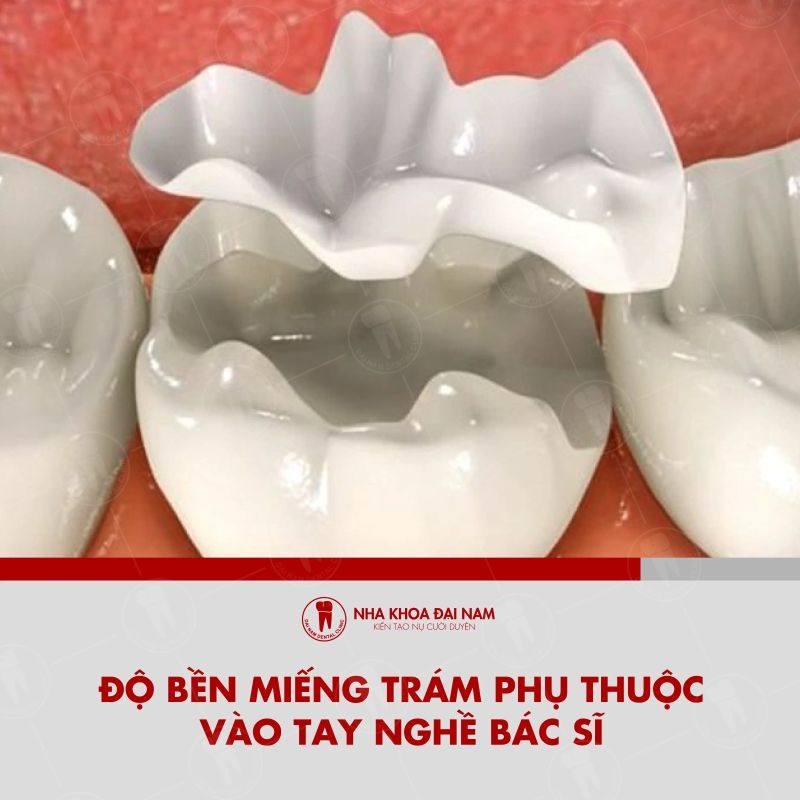 Do ben cua mieng tram phu thuoc vao tay nghe cua bac si