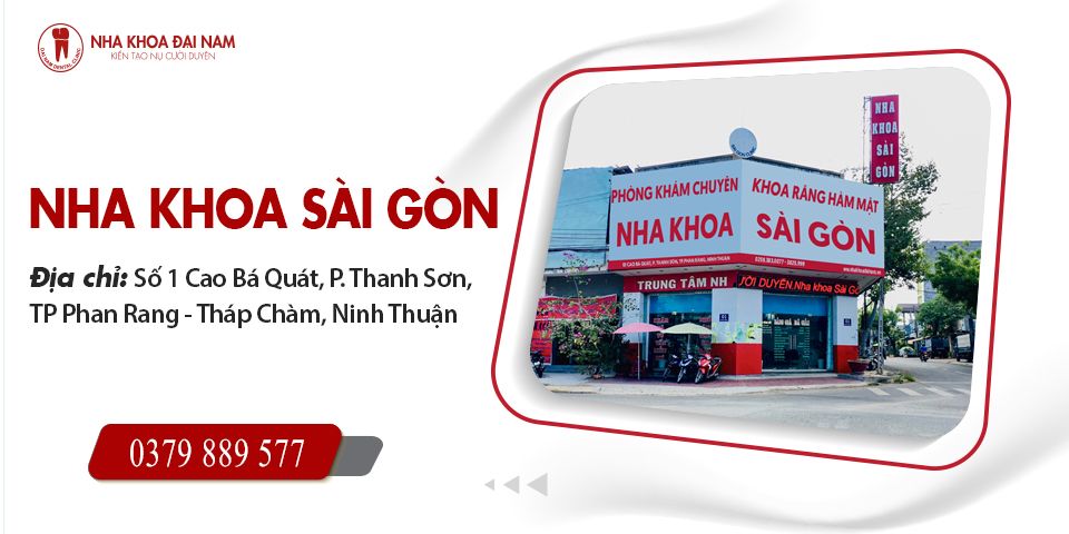Top 5 Nha khoa Trồng răng Implant ở Phan Rang uy tín