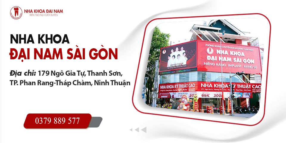 Top 5 Nha khoa Trồng răng Implant ở Phan Rang uy tín