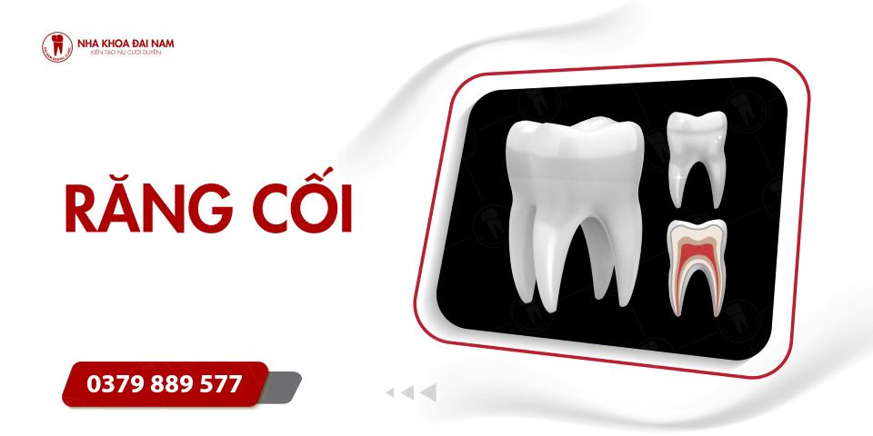 Răng cối là răng nào? Đặc điểm và vai trò? Phương pháp phục hình răng cối bị mất