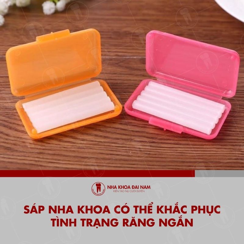 Sap nha khoa co the khac phuc tinh trang rang ngan tam thoi