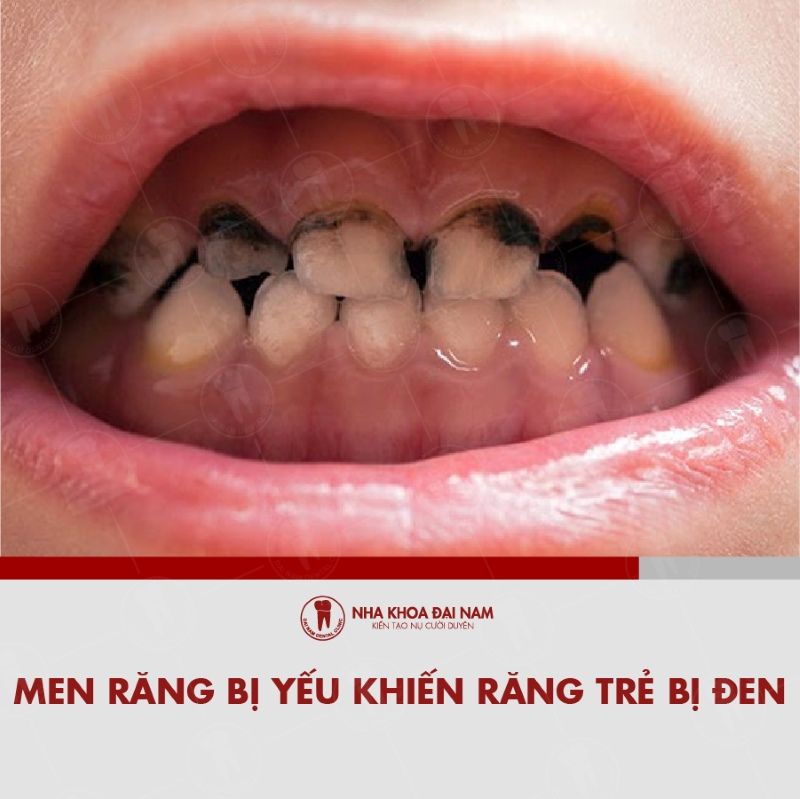 Men rang bi yeu khien rang tre bi den