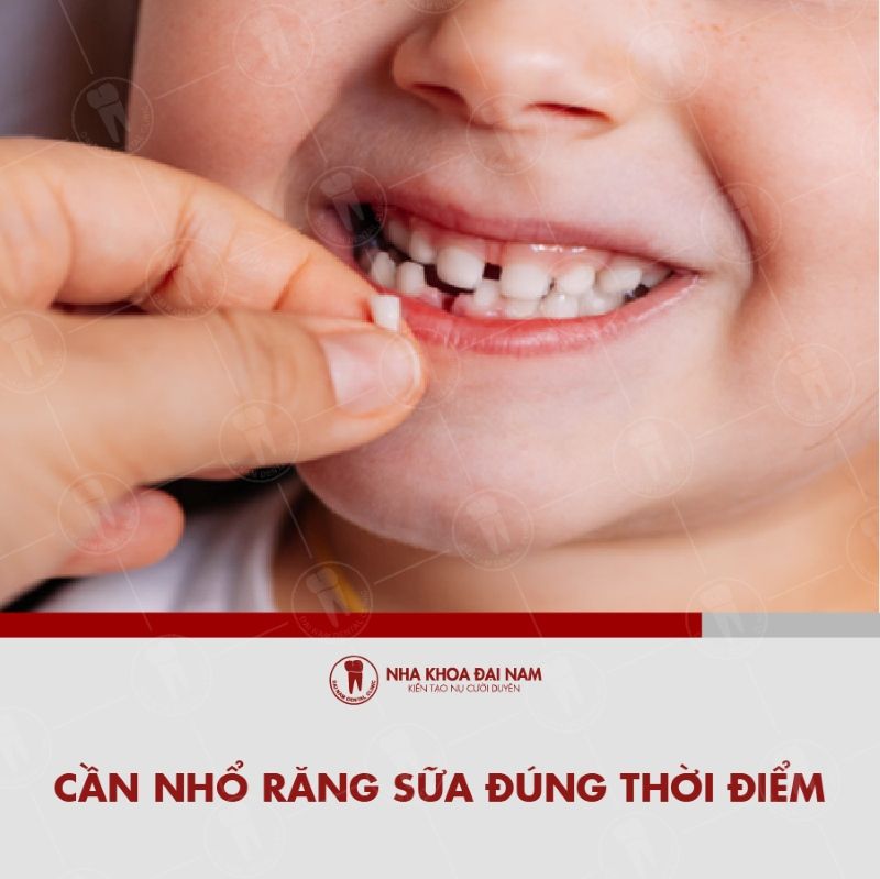 Can nho rang sua dung thoi diem de rang vinh vien moc len