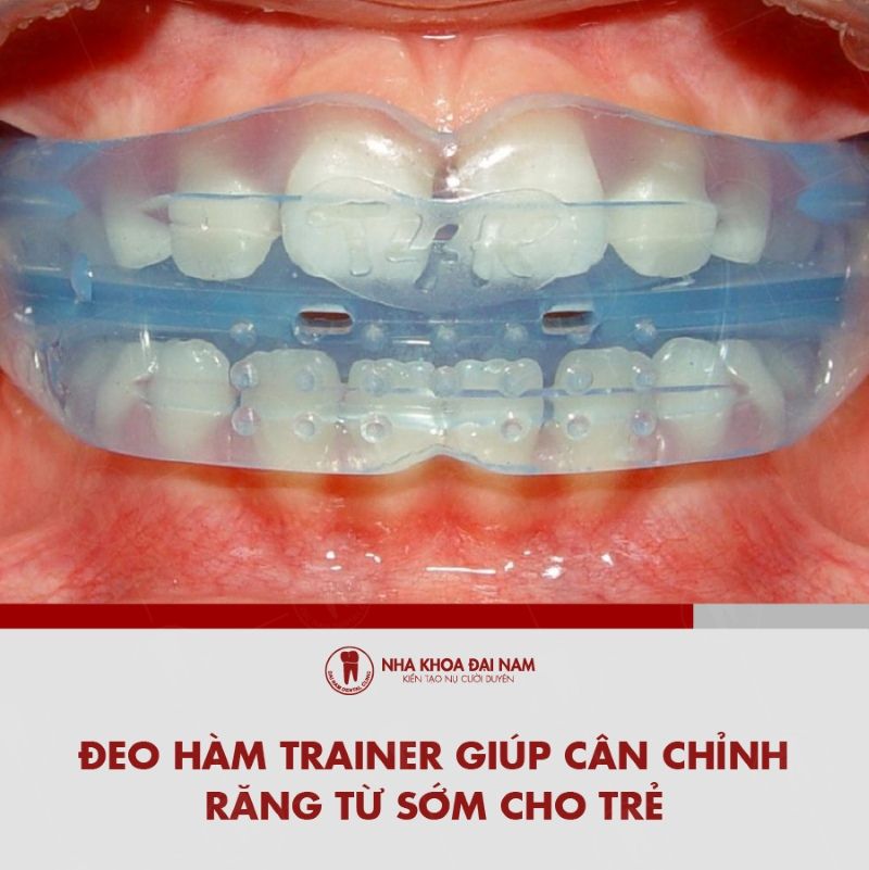 Deo ham Trainer giup can chinh rang tu som cho tre