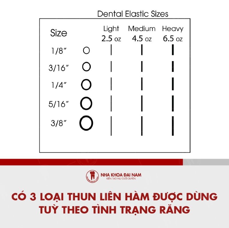 Co 3 loai thun lien ham duoc dung tuy theo tinh trang rang