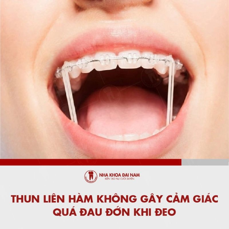 Thun lien ham khong gay cam giac qua dau don