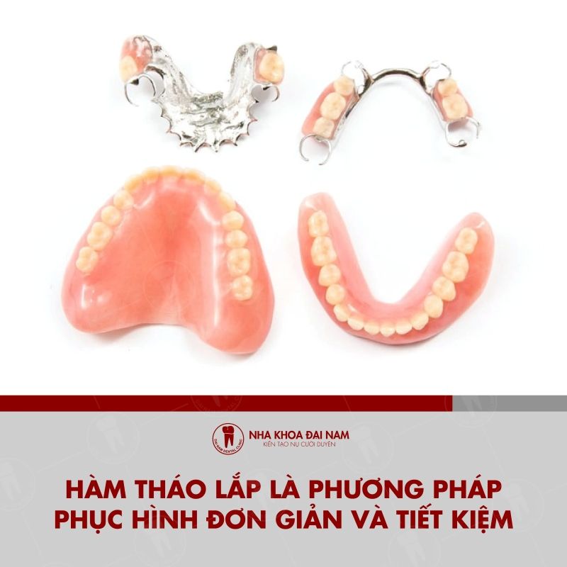 Ham thao lap la phuong phap phuc hinh don gian va tiet kiem