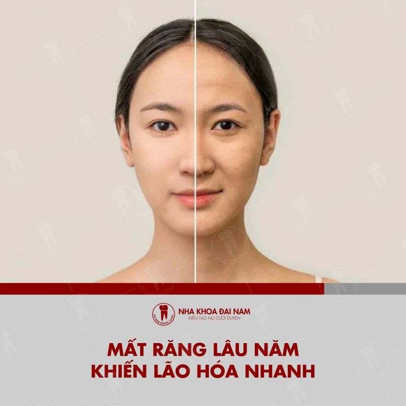 Mat rang lau nam khien lao hoa nhanh