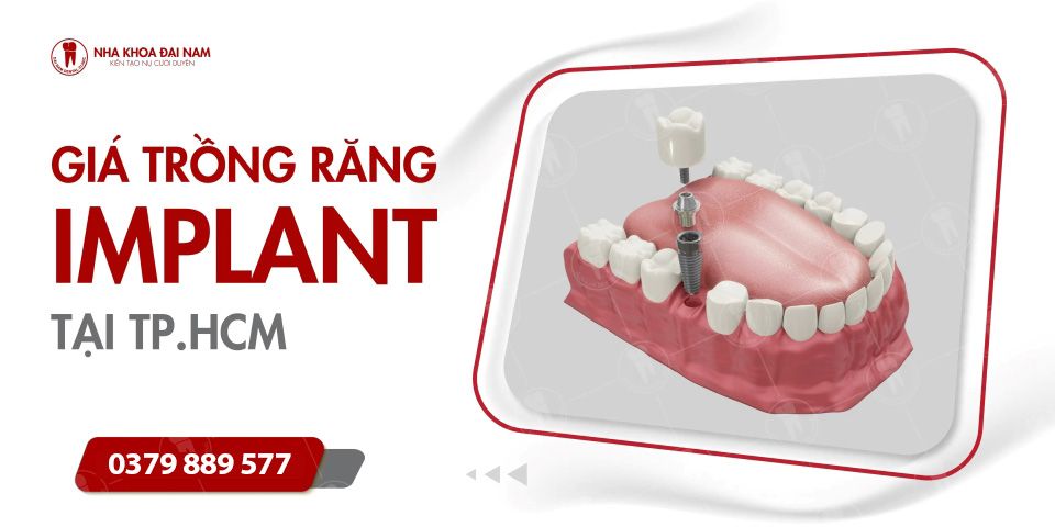 GIÁ TRỒNG RĂNG IMPLANT TẠI TPHCM MỚI NHẤT(2025)
