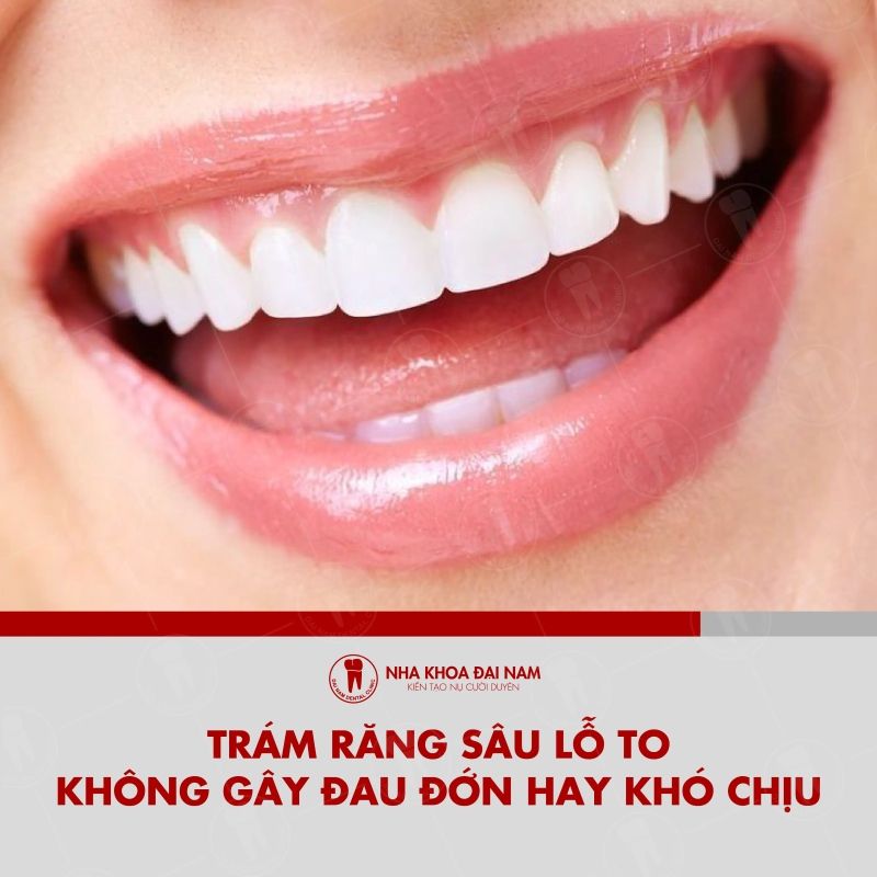 Tram rang sau hoan toan khong gay dau don hay kho chiu