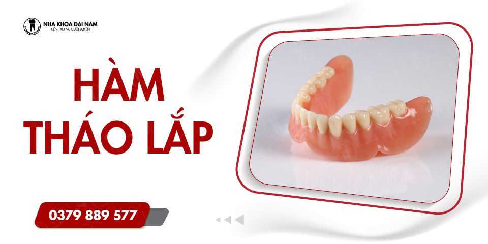 Hàm tháo lắp: Đặc điểm, phân loại và quy trình hoàn thiện