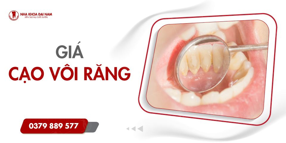 GIÁ CẠO VÔI RĂNG CẬP NHẬT MỚI NHẤT TẠI TPHCM