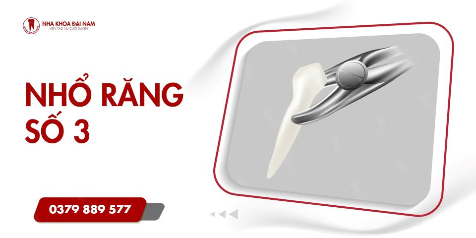 Nhổ Răng Số 3: Khi Nào Cần Thực Hiện và Những Điều Cần Biết