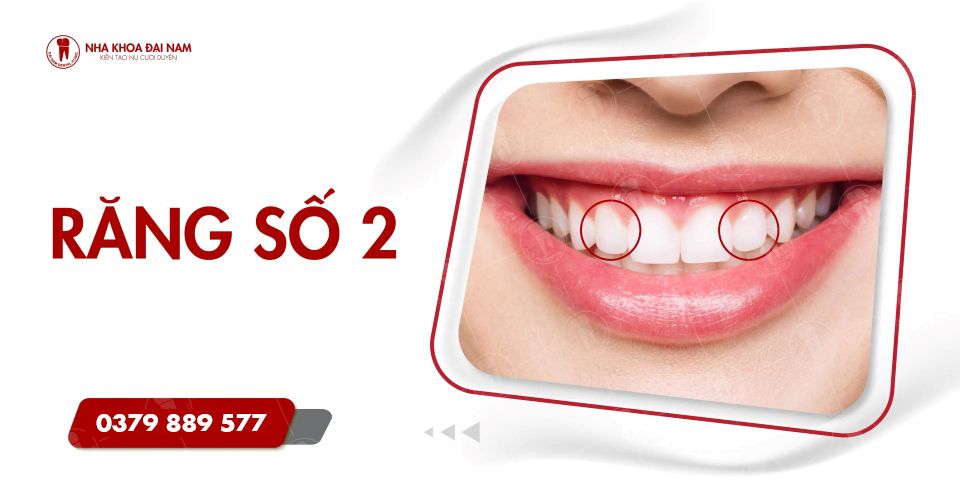 Răng số 2 là gì? Mất răng số 2 có niềng được không?