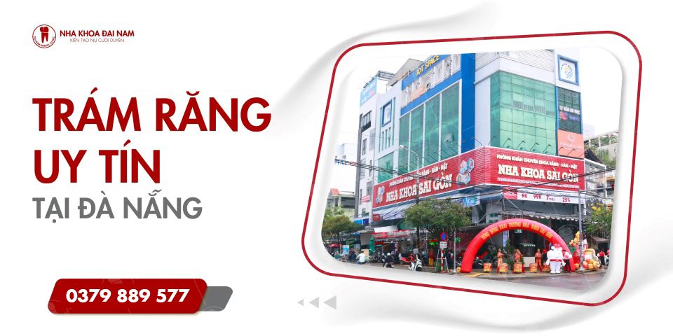 Địa chỉ Nha Khoa trám răng uy tín tại Đà Nẵng