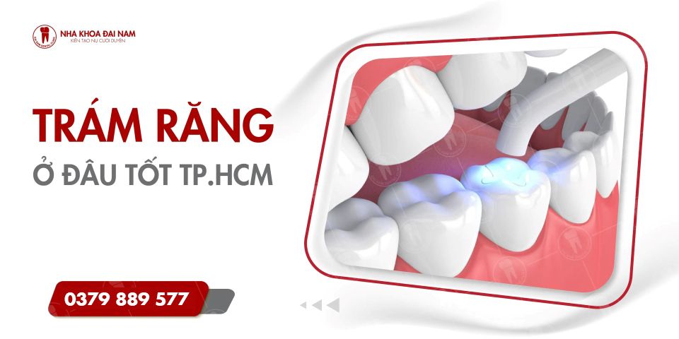 Trám răng ở đâu tốt TPHCM? Giá trám răng 2025