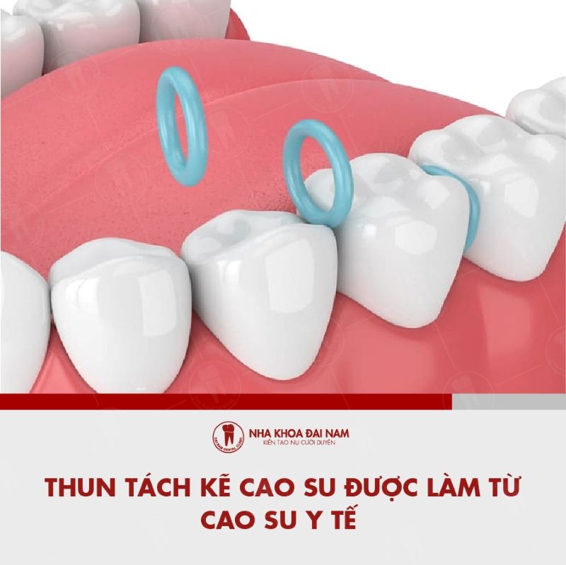 Thun tach ke cao su duoc lam tu cao su y te