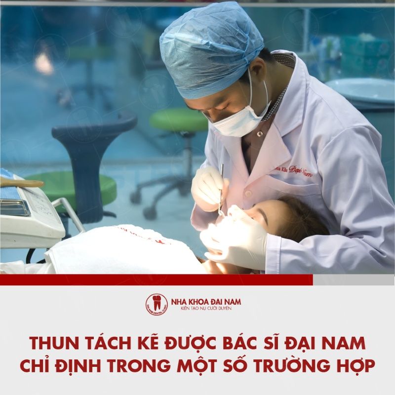Thun tach ke duoc bac si Dai Nam chi dinh trong mot so truong hop