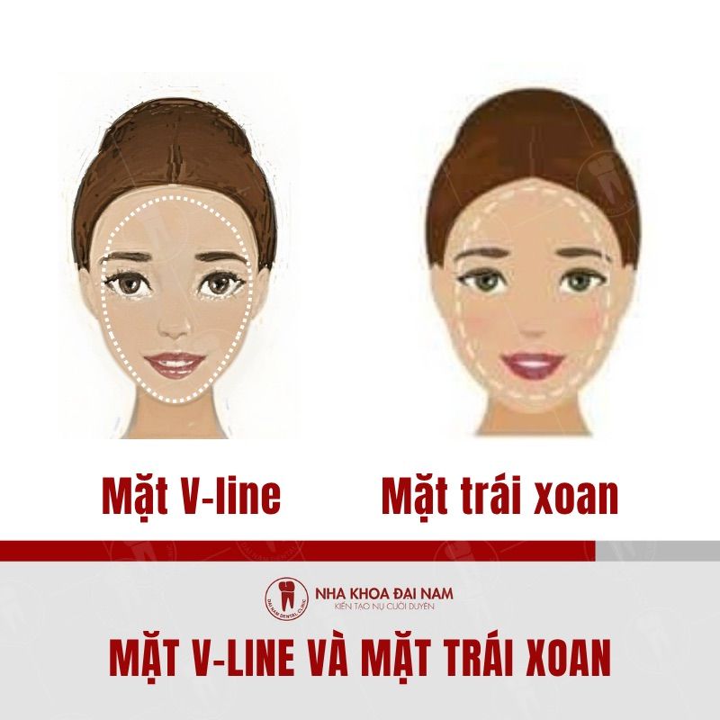 So sanh mat V-line va mat trai xoan
