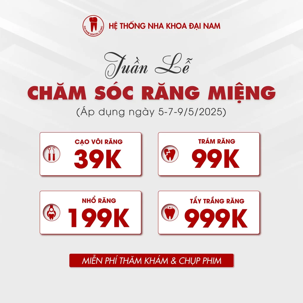 NOTE LỊCH THÁNG 5, SĂN NGAY DEAL XỊN TUẦN LỄ CHĂM SÓC RĂNG MIỆNG