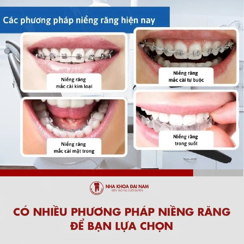 Co nhieu phuong phap Nieng rang de khach hang lua chon