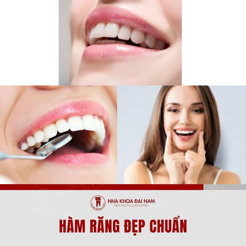Ham rang dep chuan deu khit sang khop voi khuon mat