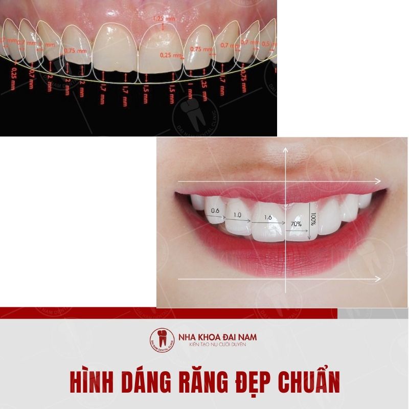 Hinh dang rang dep co kich thuoc chuan tu 0 7mm den 0 85mm