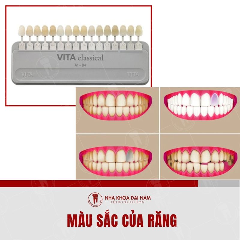 Thang do mau sac rang de tu danh gia mau sac rang cua minh