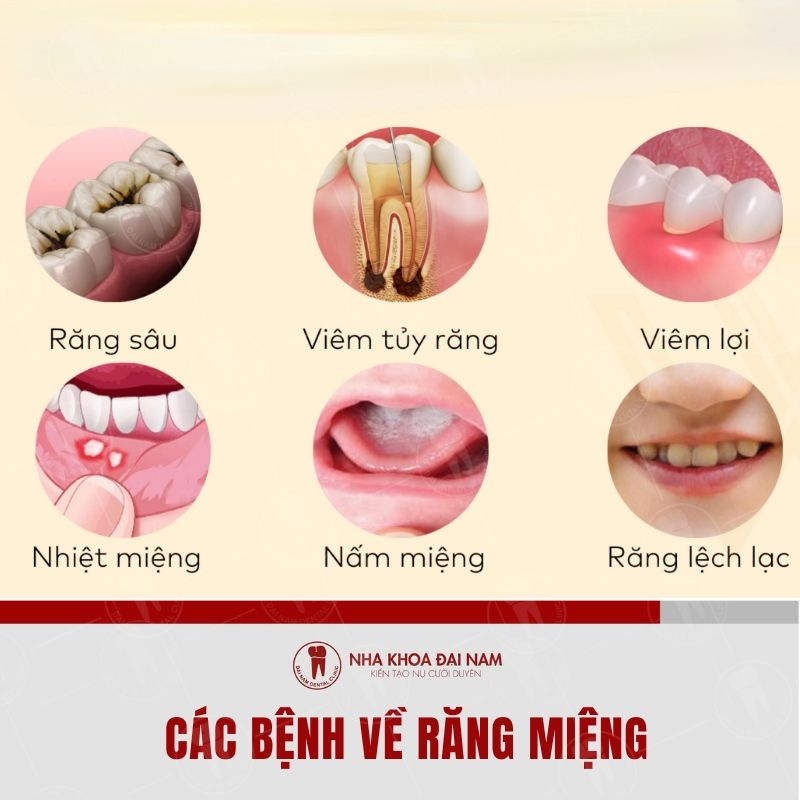 Giup giam cac tinh trang cac benh ve rang mieng