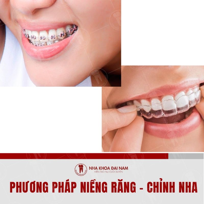 Phuong phap nieng rang se giup ban co duoc ham rang dep chuan