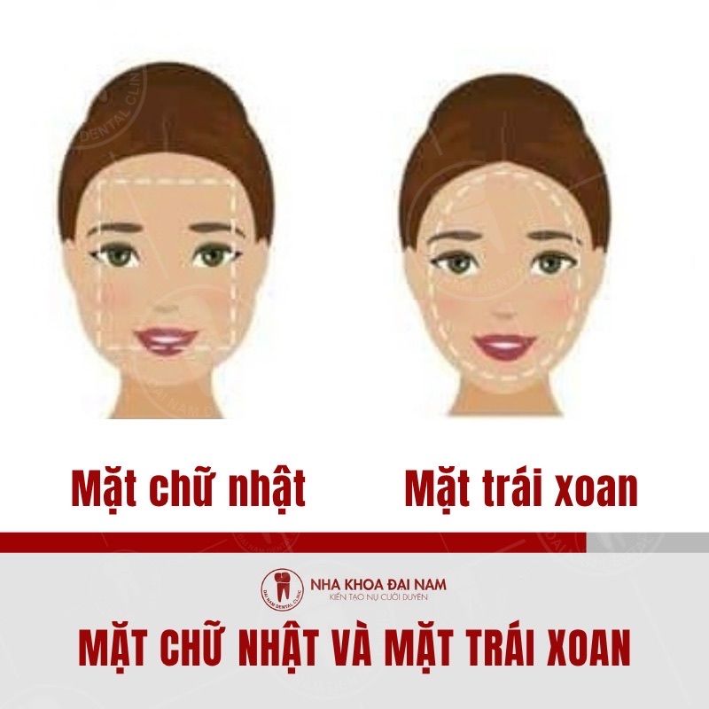 Su khac biet giua mat chu nhat va mat trai xoan