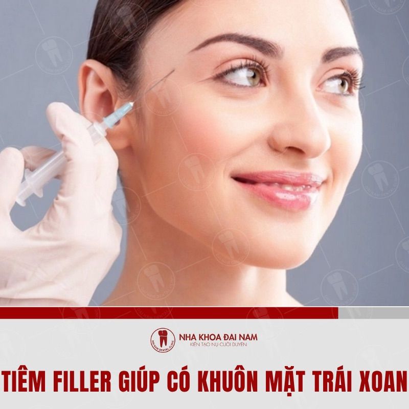 Tiem filler giup tao hinh khuon mat trai xoan