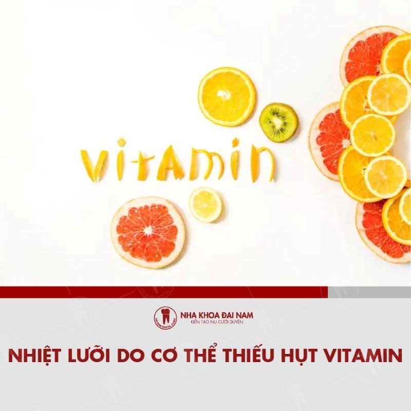 Nhiet luoi do co the thieu hut Vitamin