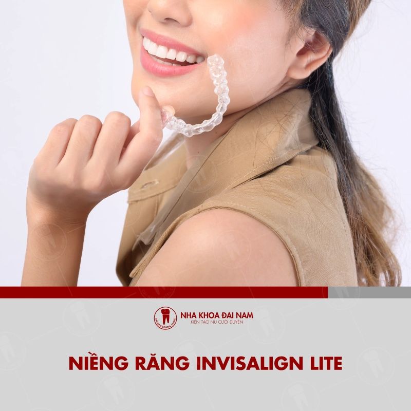 Nieng rang Invisalign Lite