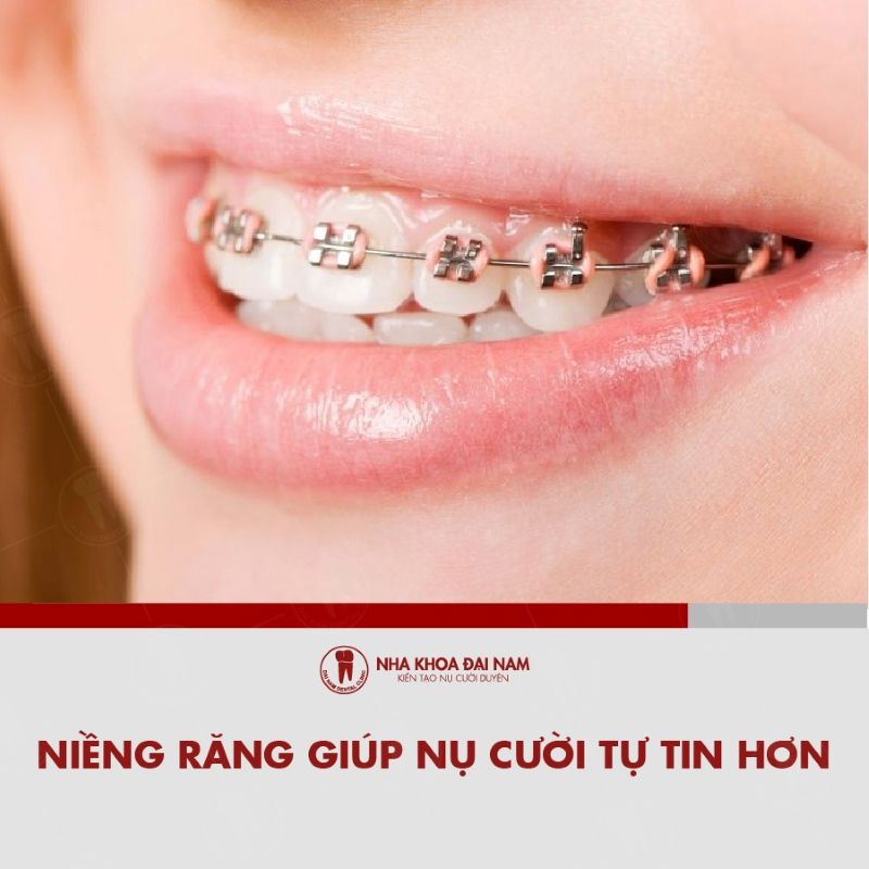 Dia chi Nieng rang uy tin gia re tai Quy Nhon