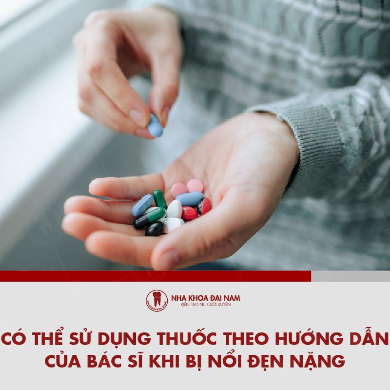 Co the su dung thuoc thep huong dan cua bac si khi bi noi den nang