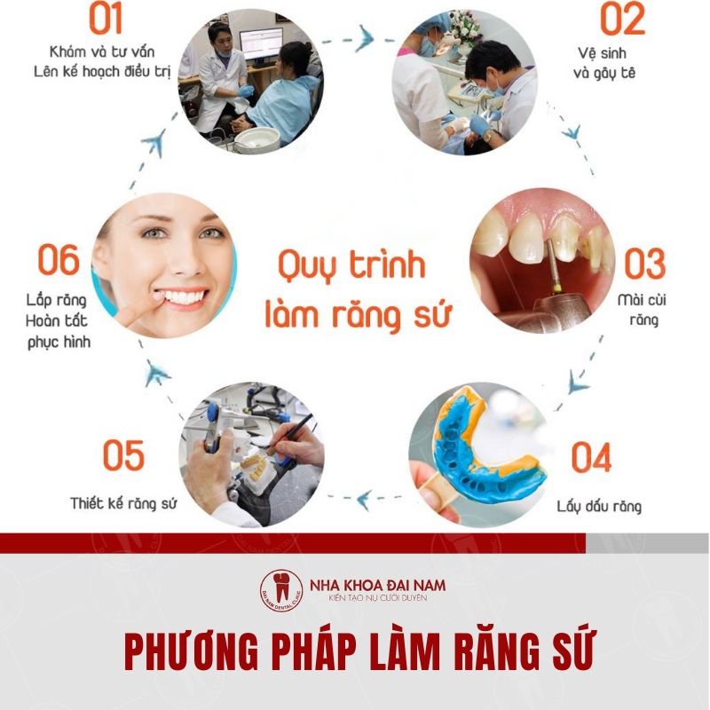 Su dung phuong phap lam rang su hien dang rat duoc ua chuong o cac nha khoa