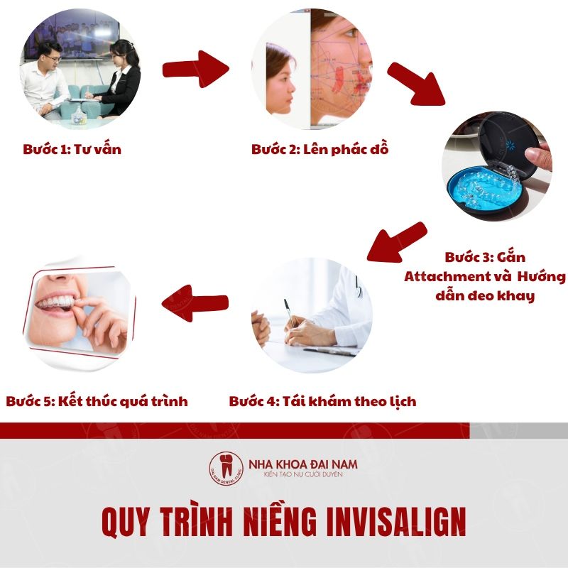 5 buoc trong quy trinh nieng rang Invisalign tai Dai Nam