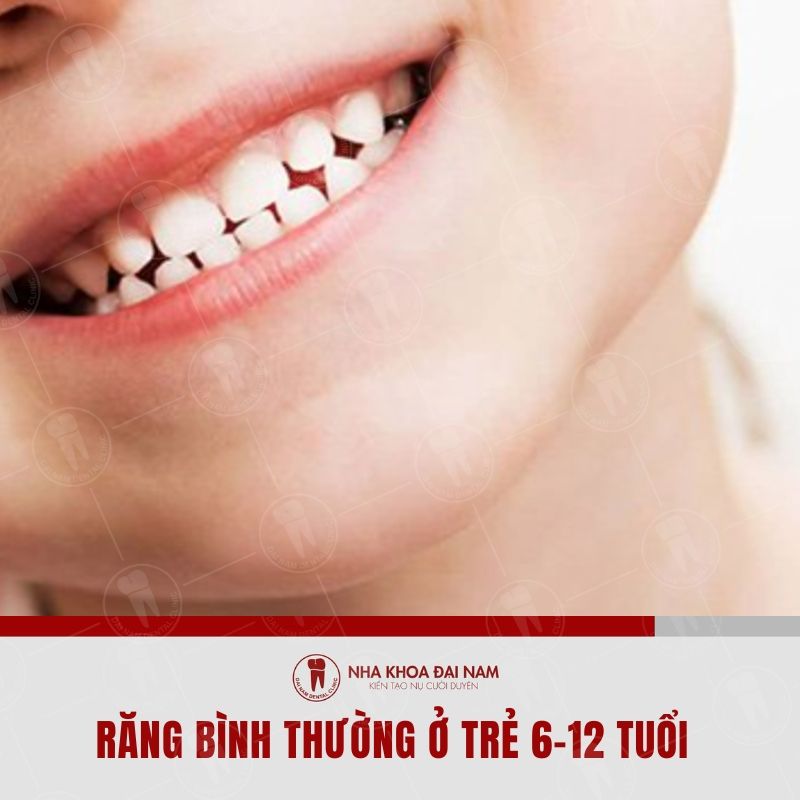 Rang moc binh thuong rang khoe moc deu dung vi tri va khop can chuan cua tre nho