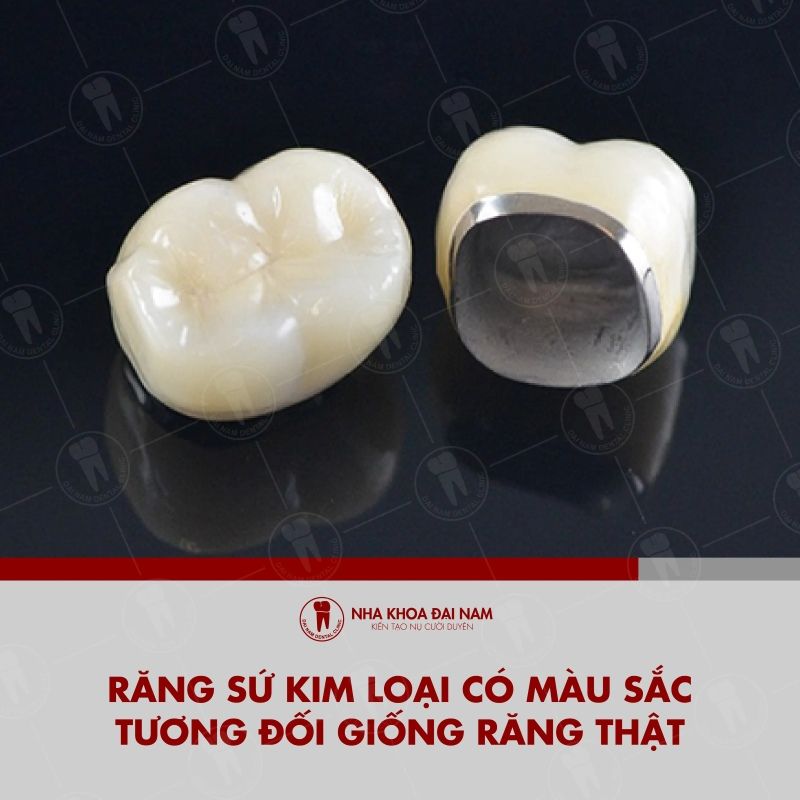 Rang su kim loai tu hop kim chiu luc nhu Crom Niken Crom Coban Titan