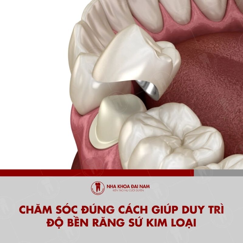 Cham soc dung cach se giup do ben rang su keo dai