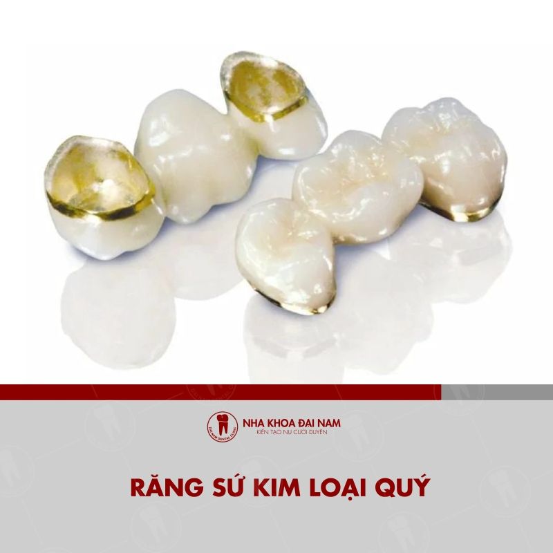Phan loi ben trong lam tu kim loai quy hoac hop kim quy