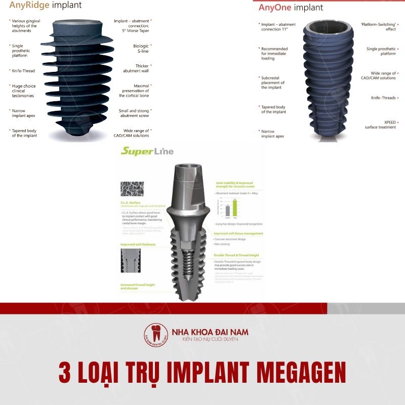 Implant Megagen co 3 loai pho bien dap ung moi nhu cau cua khach hang