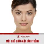 Giai dap thac mac mat chu dien la gi? Tuong so ra sao?