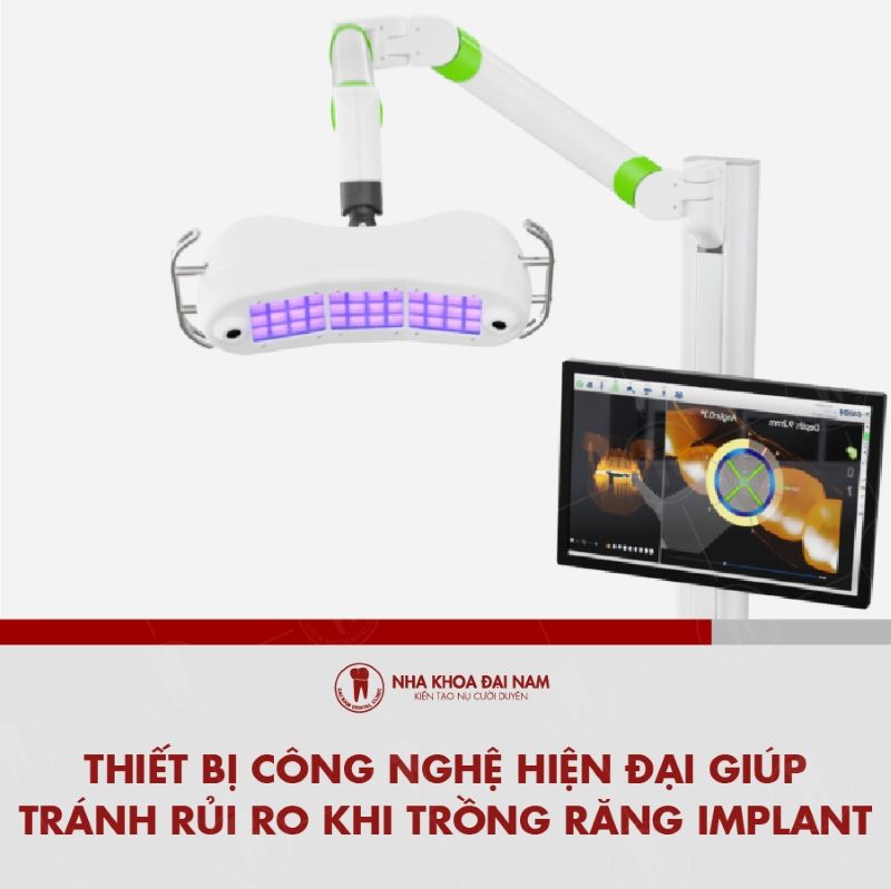 Thiet bi cong nghe hien dai giup tranh rui ro khi trong rang Implant
