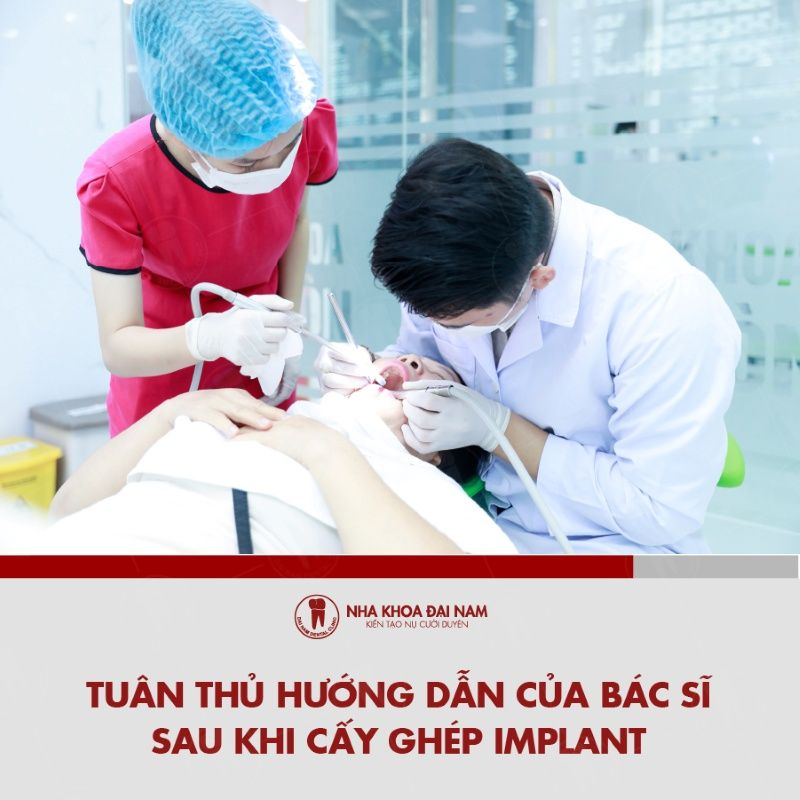 Tuan thu huong dan cua bac si sau cay ghep Implant
