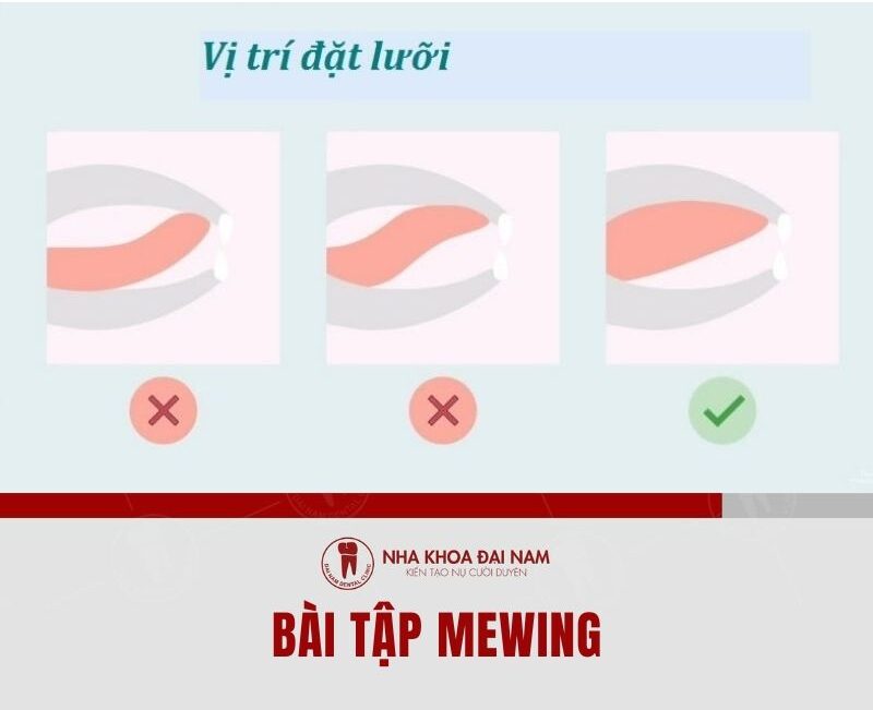 Cách cải thiện mặt lệch hiệu quả - Nha khoa Đại Nam