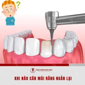 Mai nhung rang co kich thuoc chenh lech so voi nhung rang con lai